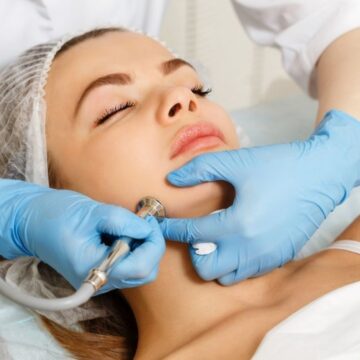 Микродермабразия - Katerina Cox