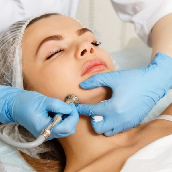 Микродермабразия - Katerina Cox